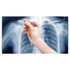 Маркер для рентгеновских пленок EDDING &laquo;8010&raquo;, БЕЛЫЙ, 0,8 мм, круглый наконечник, на лаковой основе, E-8010/<wbr/>49